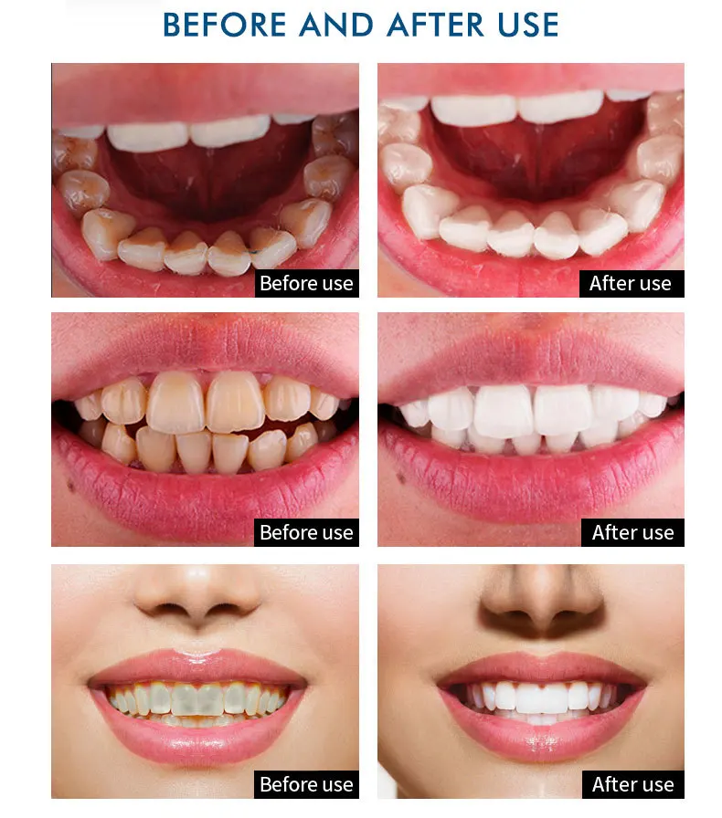 teeth-essence_12