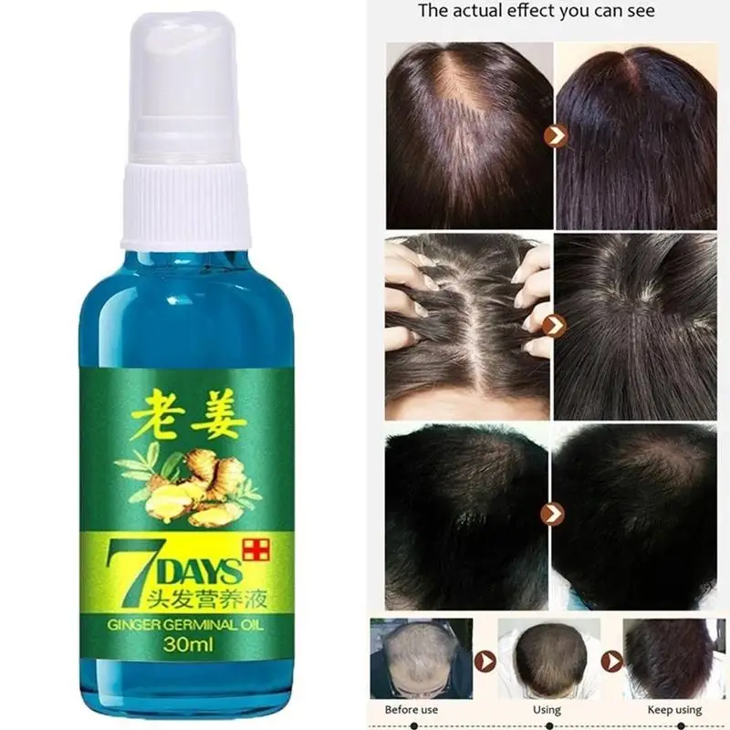 Эфирные масла для роста волос, Натуральное эфирное масло имбиря, жидкость для роста волос, забота о здоровье, красота, густые волосы для роста