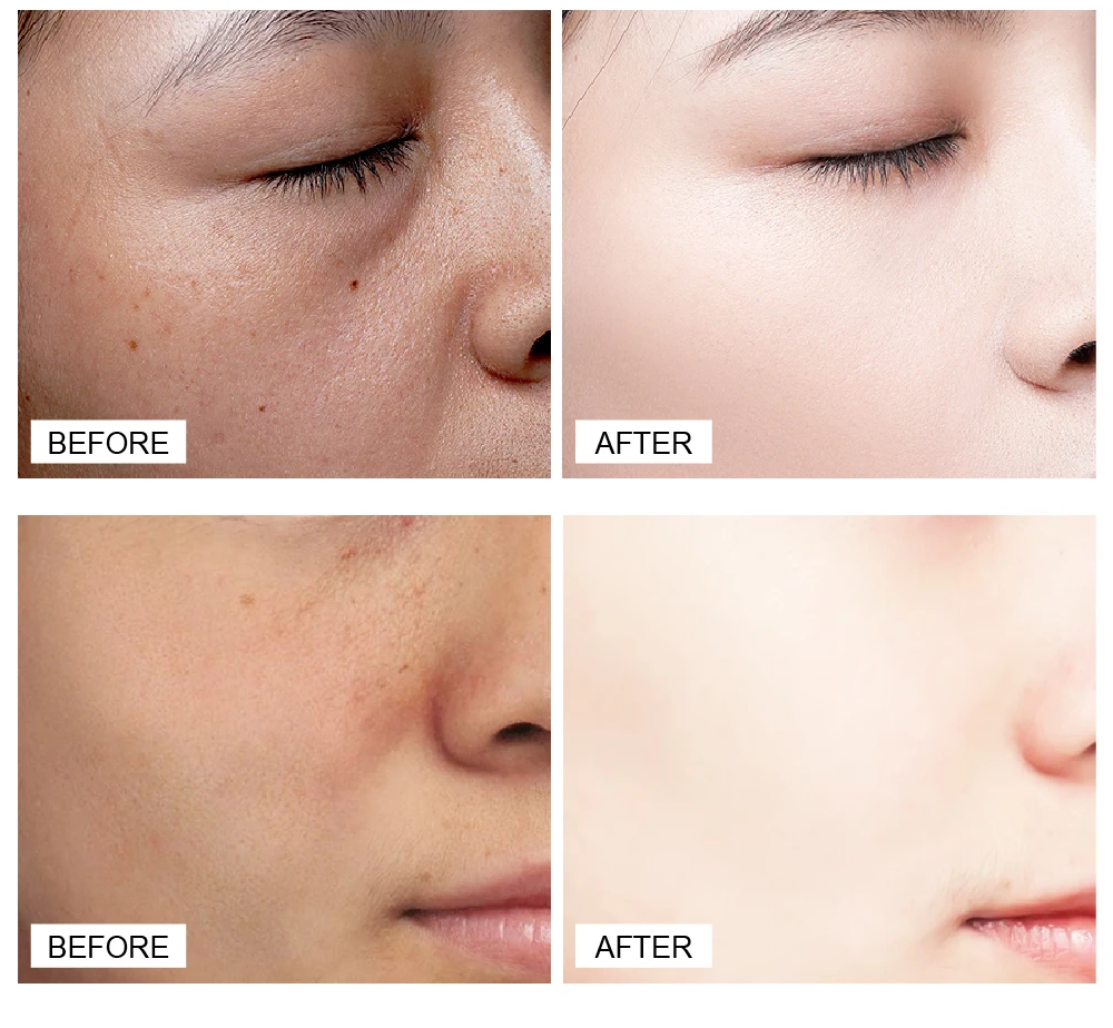 marcas facial cuidados com a pele
