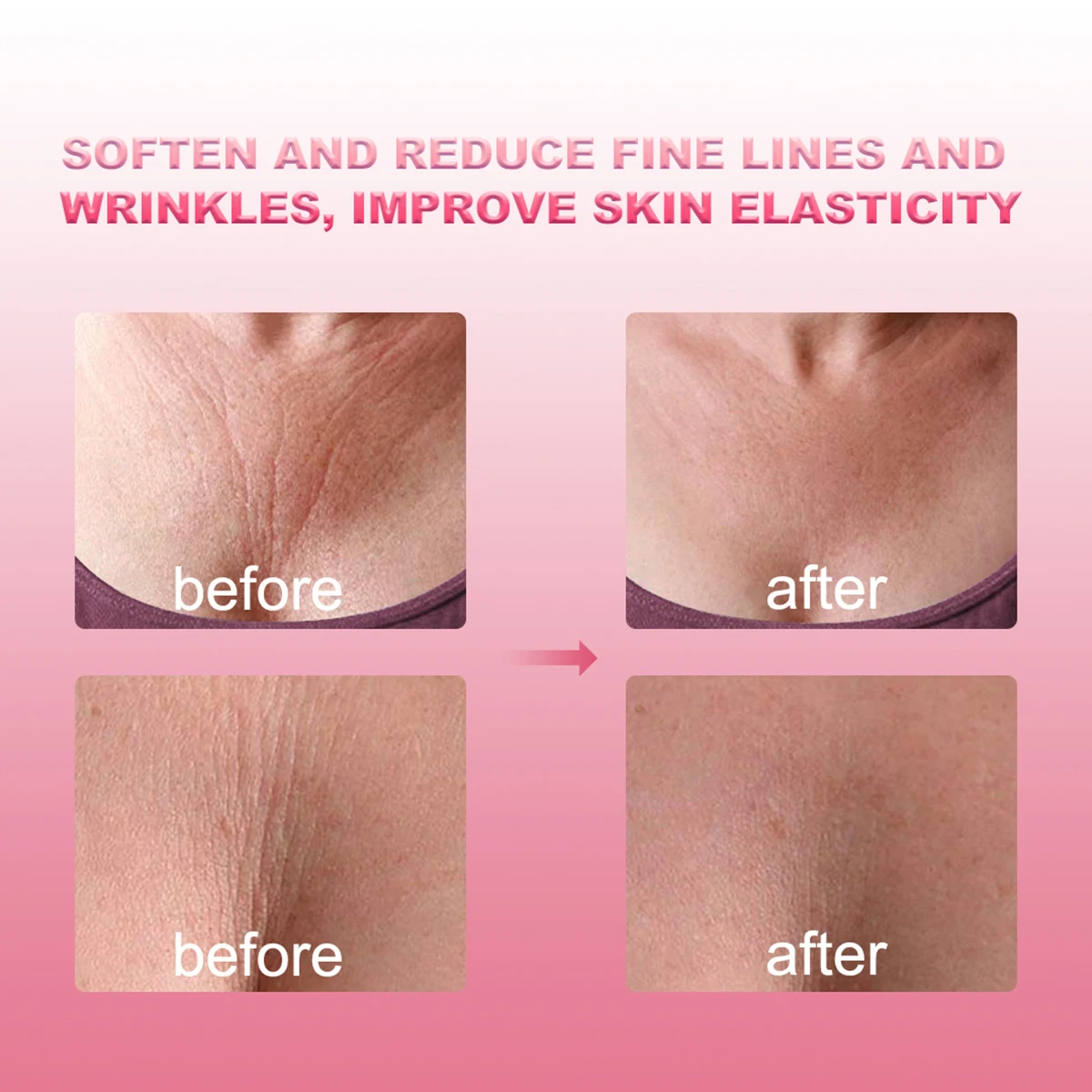 Reusable Prevent Chest Wrinkle Anti-Wrinkle Anti-aging Transparent Wrinkles Removal Silicone Chest Pads