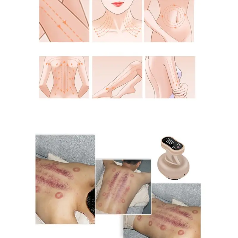 Electric Scraping Massager 9 Modes Dredge Vacuum Cupping Fatigue Pain Relieve Body Slimming Hot Com