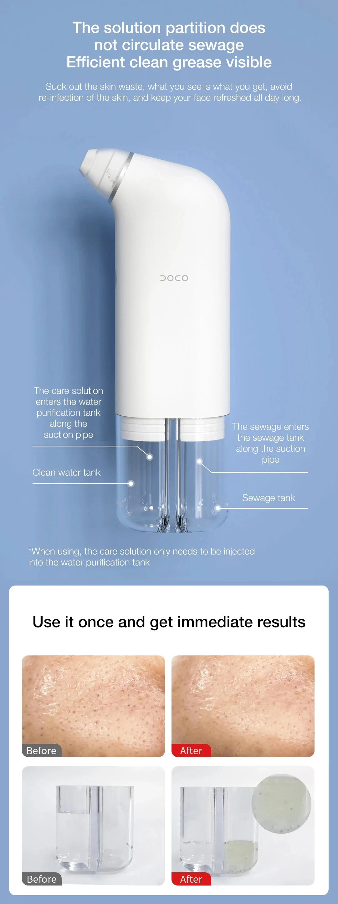 New Xiaomi DOCO Pore Vacuum Cleaner Blackhead Remover Electric Acne Cleaner Pore Cleaner Machine Facial Beauty Clean Skin Tool