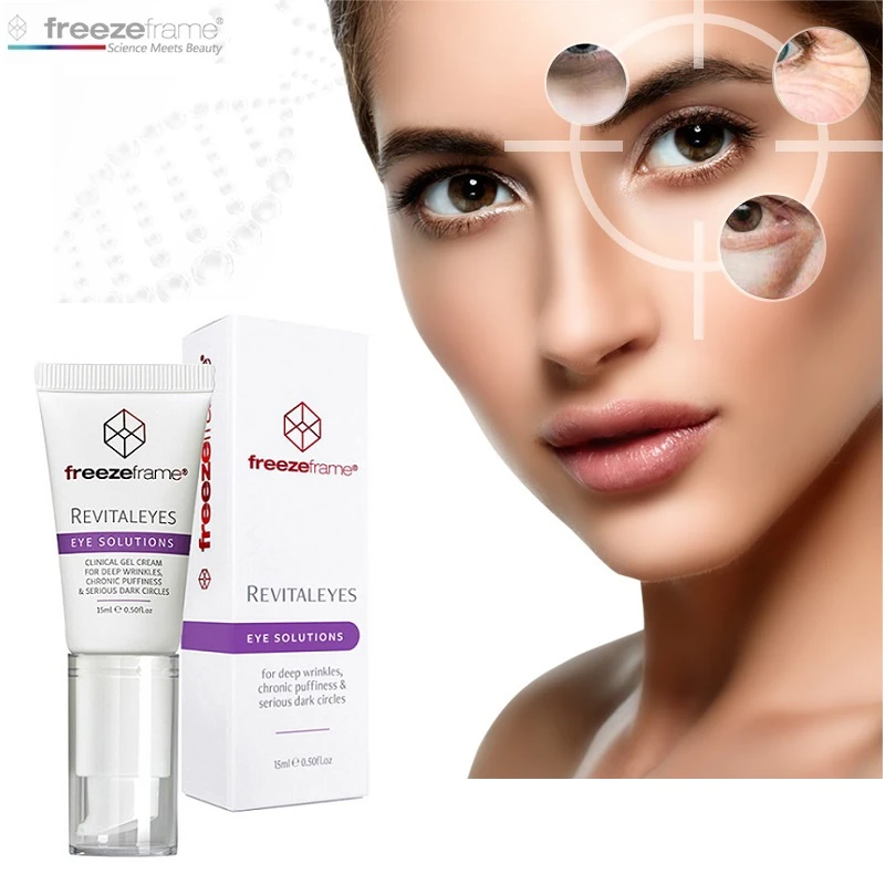 deep wrinkle between eyes