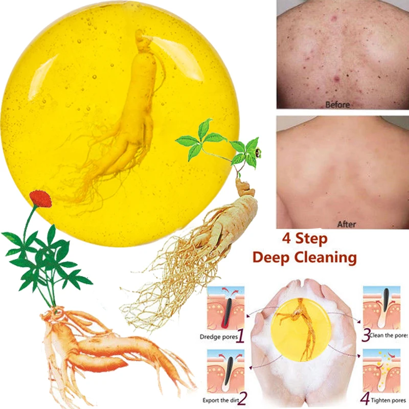 

Sophora flavescens mites soap net mites soap face wash sulfur soap ginseng cleansing handmade soap oil control to mites soap