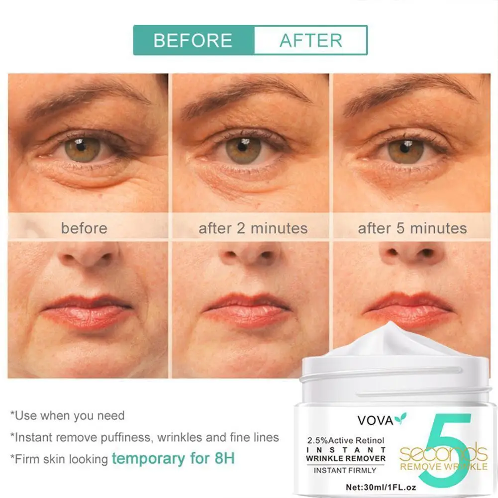 30g-retinol-eye-cream-remove-eye-bags-and-anti-puffiness-and-dark