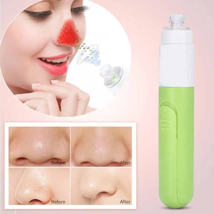 

Electric Pore Cleaner Blackhead Removal Tool Vacuum Suction Acne Pimple Cleansing Face Skin Care Machine Beauty Instrument Home