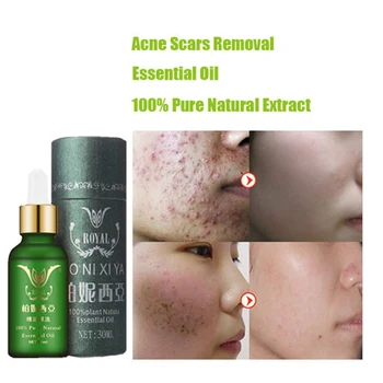 

Face Care Essential Oil Acne Scar Spots Removal Skin Care Whitening Remove Scars Acne Repair Face Cream Essence Oils R1
