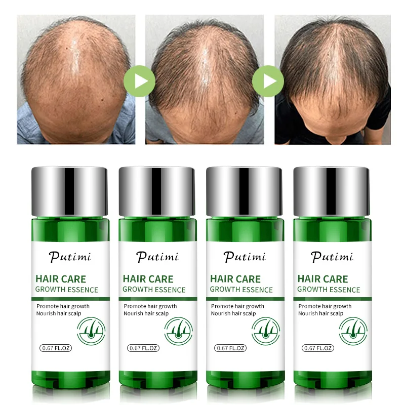 Сыворотка для роста волос Putimi сыворотка быстрого восстановления густых 20