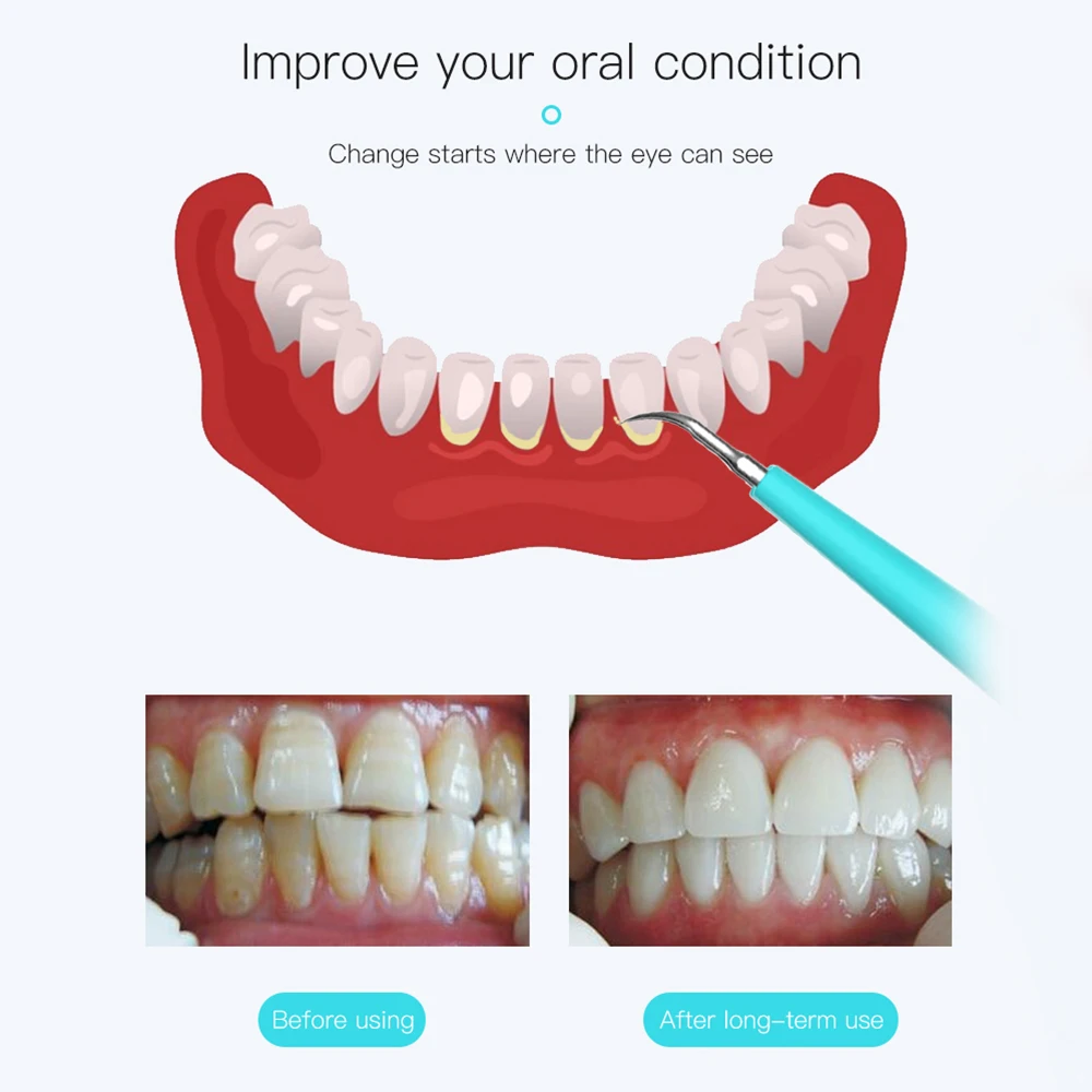 Электрический инструмент для удаления зубных камней от зубных пятен зубной камень скребок электрический инструмент для чистки зубов светодиодный светильник портативная гигиена полости рта