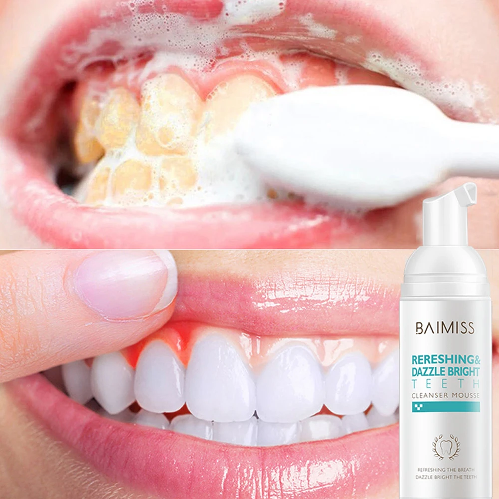 

Fresh Shining Tooth-Cleaning Mousse Toothpaste Teeth Whitening Oral Hygiene Removes Plaque Stains Bad Breath Dental Tool