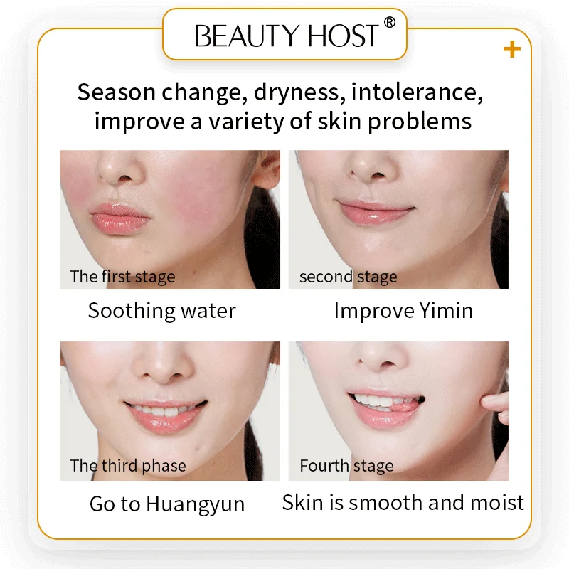 Beauty Host Ceramide Repair essence Лосьон глубокое увлажнение Блокировка воды и улучшает сухие линии и улучшает морщины