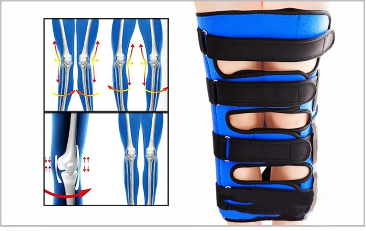 O/x Type Leg Bowed Legs Knee Straightening Adjustable Correction Belts