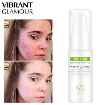 

VIBRANT GLAMOUR Tea Tree Toner Shrink Acne Pore Water Blackhead Removal Treatment Moisturizing Skin Care
