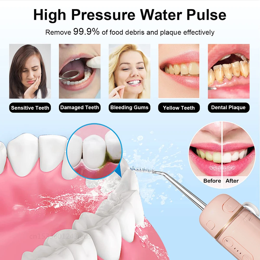 Dental Irrigator Wasser Flosser Tragbare Oral Irrigator Für Zähne USB Aufladbare Mini Zahnseide Wasser Jet Für Zu Hause Reise_voghion.com