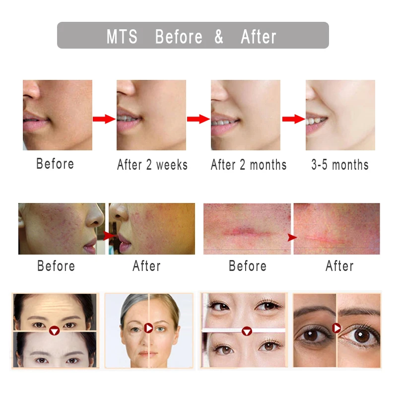 Мезороллер mezopen Microneedling Derma Pen Dr.Pen M7 C Auto Microneedle Bayonet Prot игольчатый картридж для