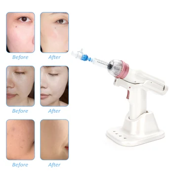 

Water Injector Mesotherapy Negative Pressure Meso Gun Mesotherapy Gun Hydrolifting Moisturizing Beauty Device Skin Care Tool