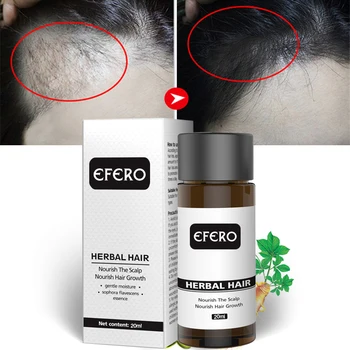 

Efero Magical keratin Hair Treatment oil Repairs Damage Hair Root Hair Tonic Keratin Hair & Scalp Treatment Essential Oils TSLM2
