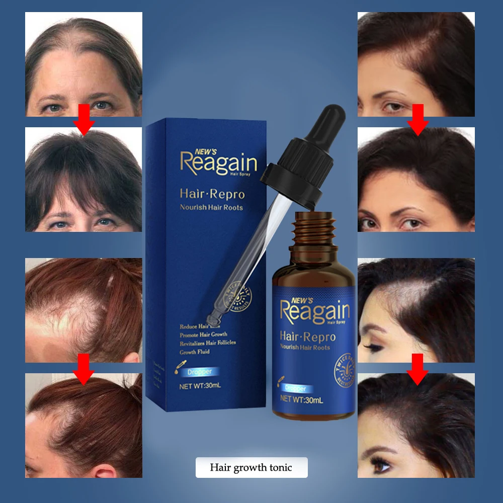 Hair Growth Essence Essential Oil Hair Growth Serum Nourishing Soften Treatment Anti Hair Loss