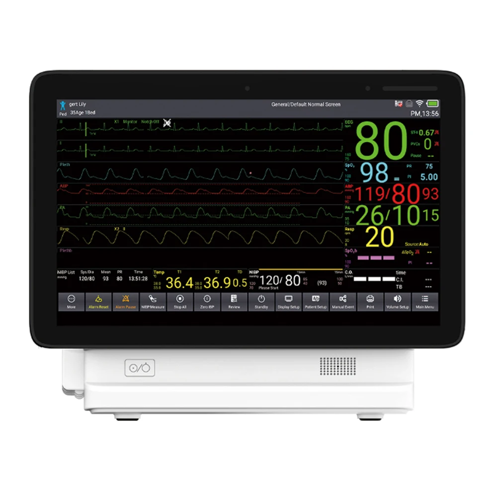 TS15 15.6 inch Touch Screen ICU CCU Module Patient Monitor 6 Parameters ECG SPO2 NIBP TEMP ETCO2 IBP