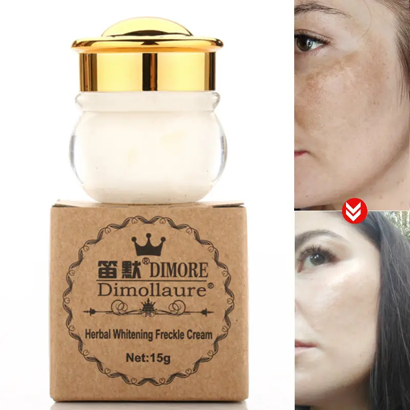 whitening freckle cream