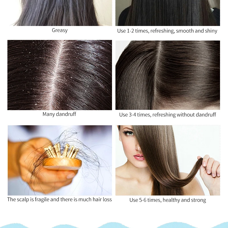 MMK拉后洗护详情页(1)_06