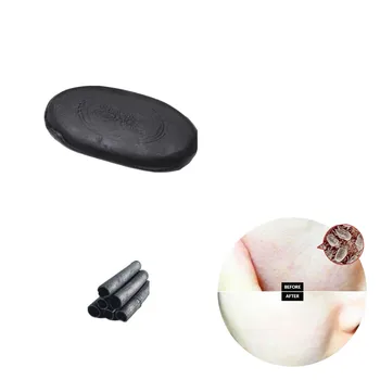 

Foundation Skin Care Cleansing Soap Cleansing facial mask soap to remove blackhead dark spots tourmaline Whitening Anti-wrinkle