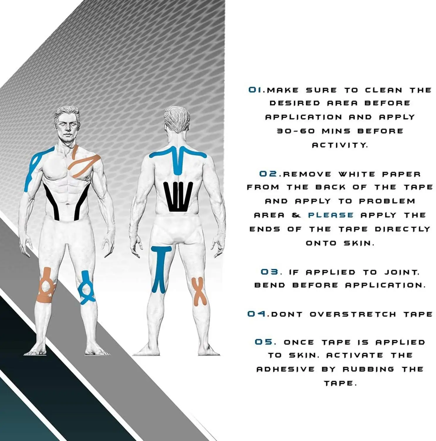 Entendendo a Síndrome de Osgood-Schlatter no Joelho, image size:1486x1500