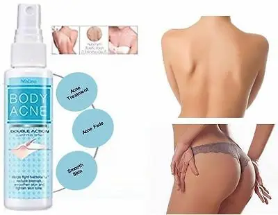 

Mistine body acne treatment spray flights body back chest butt pimple 50ml