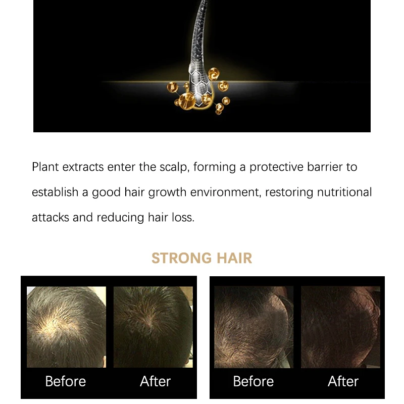 防脱精油详情页_08