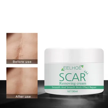

30g Freckles Treatment Scar Cream Remove Scar Dark Spots Cream Repair Fade Acne Stretch Mark Skin Care Whitening Cream TSLM3