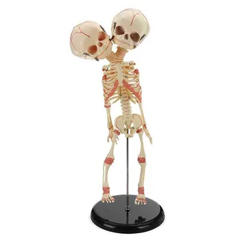 

Double-headed Infant Skeletal Model Human Newborn Baby Double Head Anatomy Skull Skeleton Anatomical Brain Education Anatomical