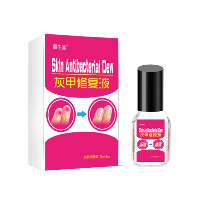 Купить Natural Herbal Medicine Nail Anti Onychomycosis Paronychia ...