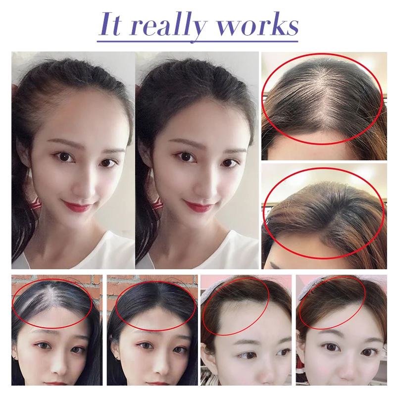 Skup Do włosów serum wzrostu Essential Oil Anti utrata włosów leczenie uszkodzenia naprawy włosów leczenie gęste szybki wzrost włosów tonik do włosów