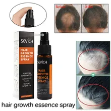 Спрей для роста волос мощное средство для борьбы с выпадением волос спрей против выпадения волос, лечение плотные тонкие Предотвращение волос облысения X#4