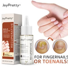 

Joypretty Nail Fungus Treatment fungus remedy Essence Serum Removal Gel Anti Infection Paronychia Onychomycosis Care 20ml