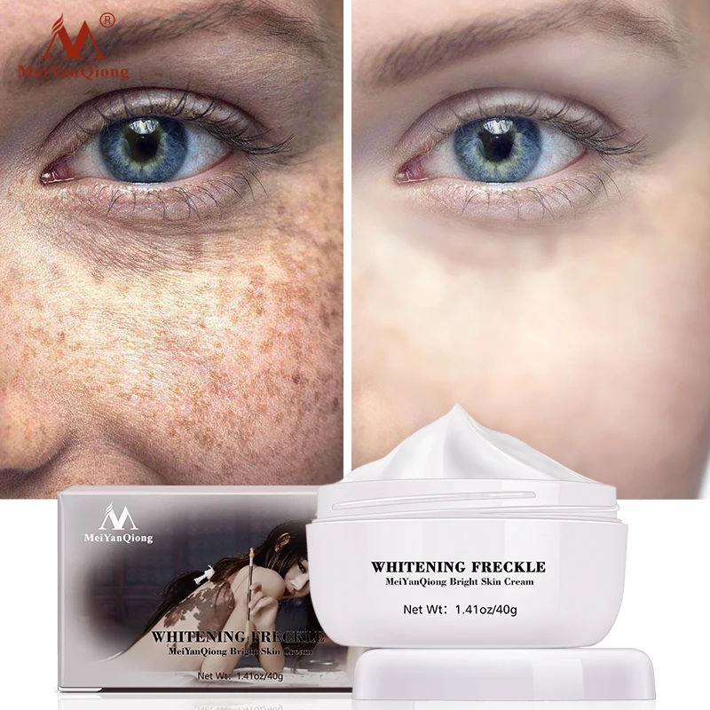 powerful skin whitening cream