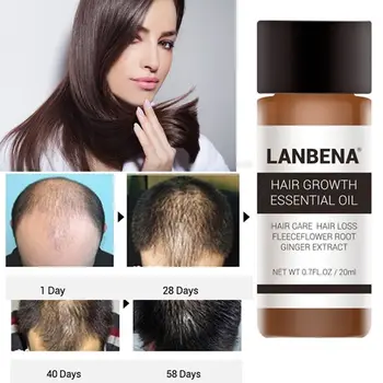 

1 Bottle 20 ml Powerful Fast Hair Growth Essential Oil Treatment Anti Hair Loss Natural Hair Care Liquid For Men/ women TSLM2