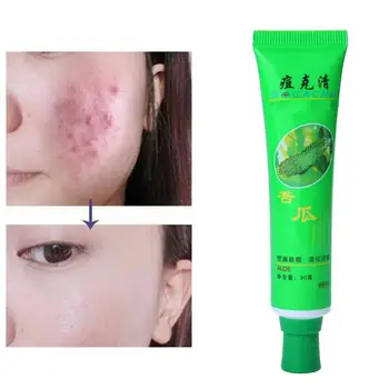 

Face Skin Care Acne Cream Oil Control Acne Products Moisturizing Cream Face Acne Face Beauty Aloe Skin Remove Vera Care Cre K3G0