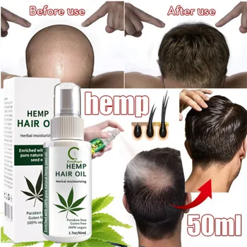 

GPGP Greenpeople 30Days Hemp Hair Growth Spray 50ml Fast Grow Ginger Hair Essence Hair Treatment Preventing Hair Loss Spray