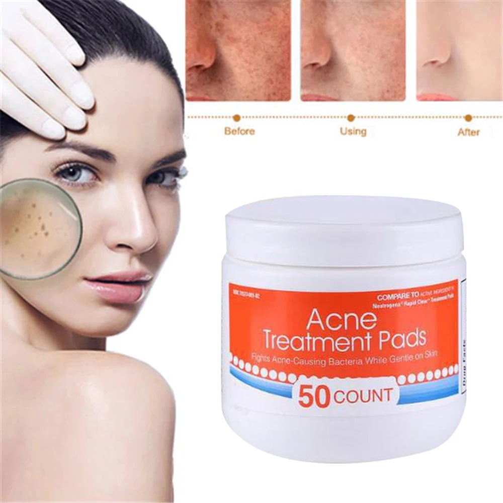 50 шт./бутылка Acne хлопковый коврик для лечения акне, очищающая средство для лица, впитывает гной и масло, не высушивающая маска для ухода за кожей лица