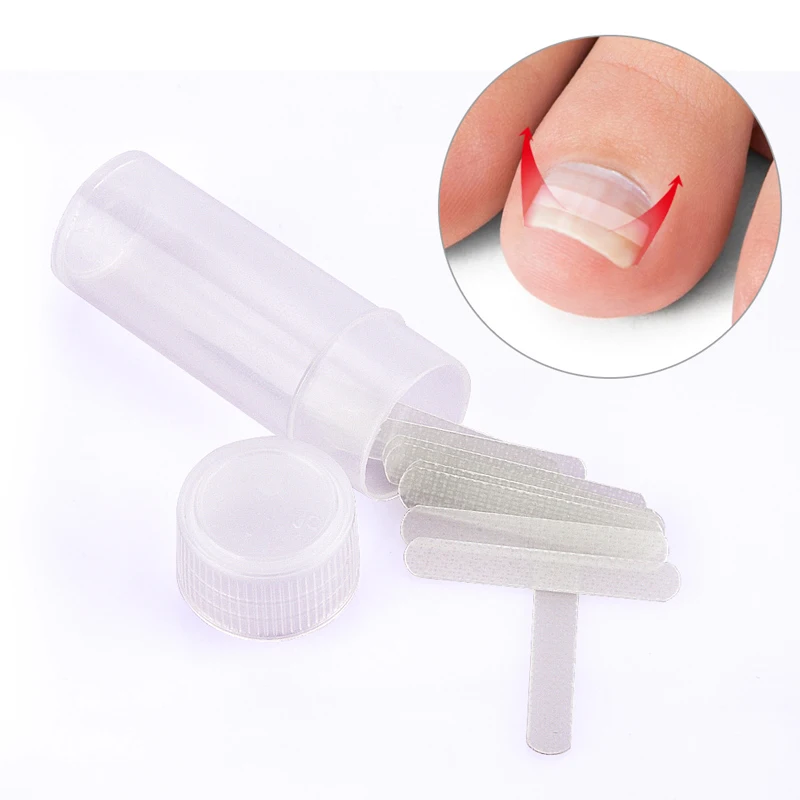 Ingrown Toe Nail Correction Sticker Patch Paronychia Corrector Pedicure Tools Elastic Patches Foot Care Straightener Treatment Ingrown Toe Nail Correction Sticker Patch Paronychia Corrector Pedicure Tools Elastic Patches Foot Care Straightener Treatment