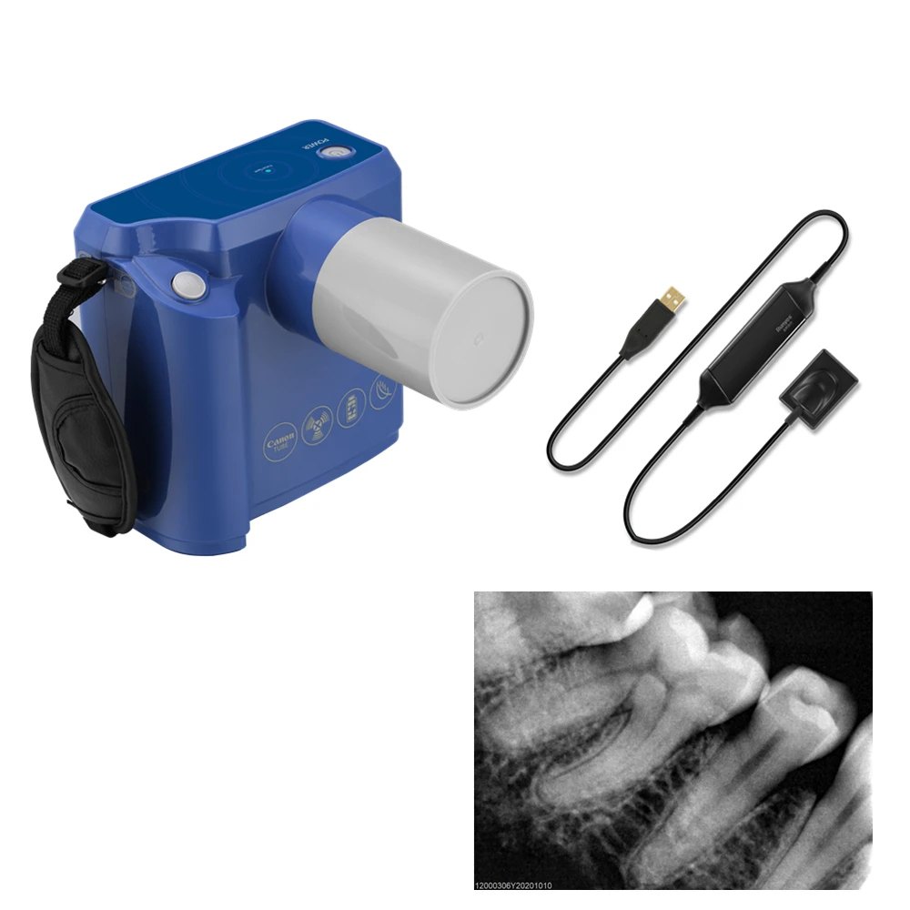 

Runyes New Digital Portable Small Dental X Ray Machine Sensor