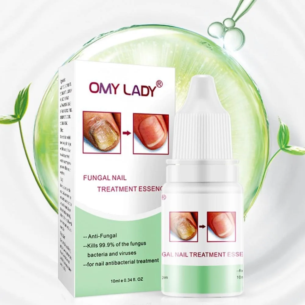 OMY LADY, высокое качество, защита для ногтей, крем для ухода за кожей, Лечение грибка ногтей, восстанавливающий крем, инструменты для ухода за ногтями