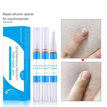 Раствор для ухода за ногтями, ремонт ногтей, ингибирование грибковых инфекций, уход за ногтями