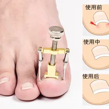 1 шт. полезный вросший ноготь коррекция ног Инструмент Педикюр закрепитель для ногтей на ногах Уход за ногтями на ногах инструмент ортопедический корректор для педикюра LJ20