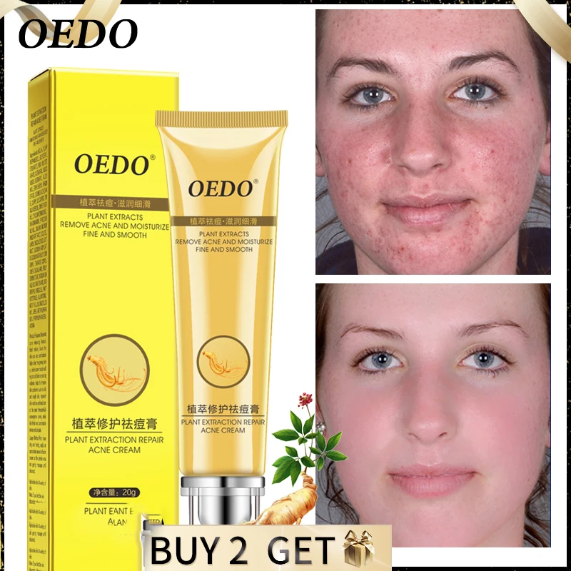 

OEDO Plant Extraction Repair Acne Cream Ginseng Extract Acne Treatment Scar Remove Shrink Pores Face Skin Care Facial Cream 20g