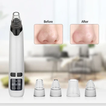

Electric Pore Cleaner Blackhead Remover Vacuum Suction Vacuum Cleaner Black Dot Face Nose Acne Cleansing Skin Care Tools