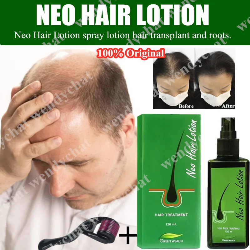 Neo Hair Lotion Dubai - Neo Hair lotion is a perfect remedy for Baldness,  Hairfall. Its made with selected ingredients that stop hair falling, and  regrow hairs on Bald regions with use