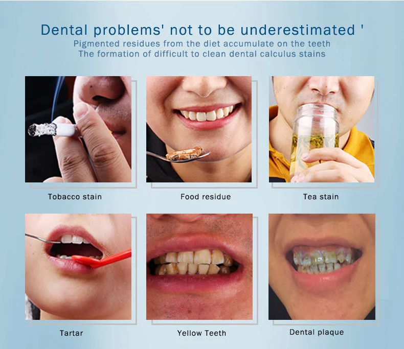 teeth-whitening-serum_03