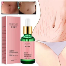 Средство для удаления растяжек после родов крем против морщин чистый натуральный крем для Удаления растяжек эфирные масла Горячая Распродажа